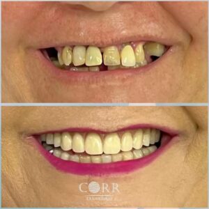 Corr Odontologia - Cuide do seu sorriso