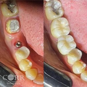 Corr Odontologia - Cuide do seu sorriso