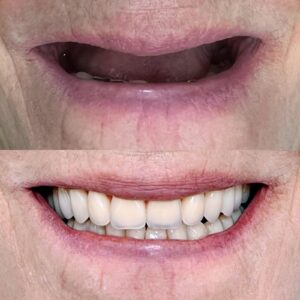 Corr Odontologia - Cuide do seu sorriso